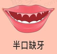 分享我在北京瑞泰口腔种牙经历，看医生如何挽救这口烂牙