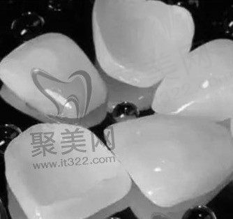 全瓷贴面是全瓷牙吗图片，全瓷贴面跟全瓷牙的区别本文有