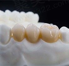 想知道全瓷牙和烤瓷牙的区别是什么?这两种价格哪个更贵呢？