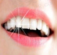 回答皓齿美白和冷光美白哪个好？二者价格及优缺点抢先看