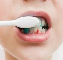 牙周红肿出血怎么治疗牙医在线支招，遇到牙龈出血要警惕三种病