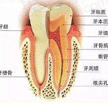 牙龈炎和牙周炎的区别是什么？得了牙周炎一辈子就完蛋了吗？
