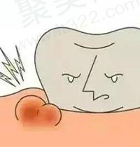 根尖囊肿需要拔牙吗？有人说根尖囊肿拔掉牙就好了是真的吗