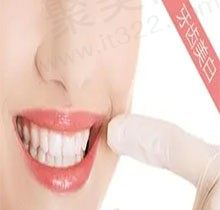 牙齿美白哪种方法好对牙没有伤害,价格大概多少钱