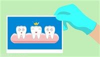 10岁儿童牙齿摔断一半怎么办？门牙断了合适的修复时间是啥时候
