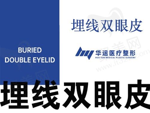 哈尔滨谁家双眼皮做的好？华运医疗美容诊所埋线双眼皮700元起很自然