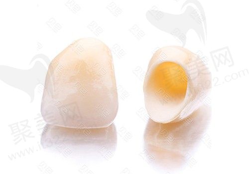 找不同之烤瓷牙与全瓷牙，各自的优点有哪些？