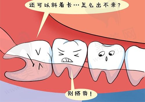 智齿坏了一半烂掉了是拔还是补？是不是智齿烂了一定就要拔？