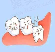 热点！智齿不疼也要拔吗？叙述智齿不疼不用拔的几种情况