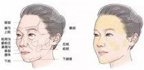 热玛吉后遗症有多严重？热玛吉做完一个月觉得脸更加垮了咋回事