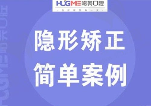 青岛哈美口腔崂山店怎么样？时代天使隐形矫正仅需19800元起？
