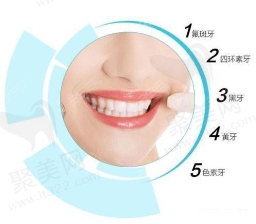 冷光美白一周后变黄了是为什么？听说冷光美白牙齿对伤害巨大