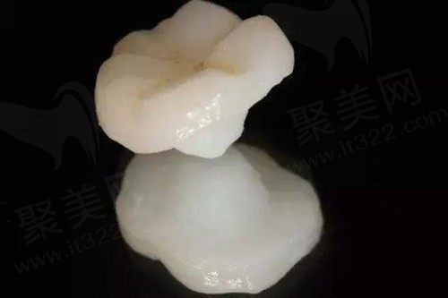 牙齿表面的牙釉质掉了能修复吗？如果不能自愈，要花多少钱？