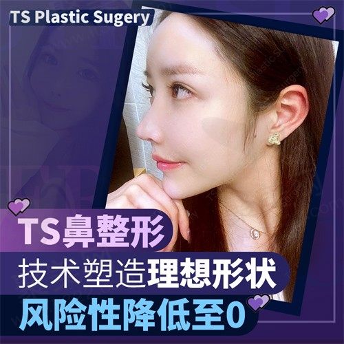 韩国TS整形医院隆鼻手术，打造“颜值高峰点”，更加自信迷人！