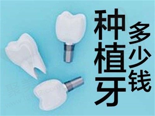 解答2023杭州种植牙齿价格多少，含韩系/欧美进口种植牙
