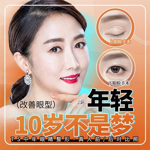 TS中年眼部整形（上眼睑、下眼睑），改善眼型, 让你年轻10岁不是梦！