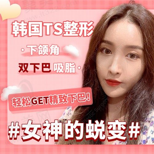 韩国TS整形医院下颌角+双下巴吸脂手术，打造自然V-line风，提升气质让你更迷人！