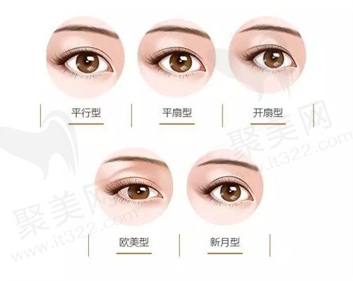 朋友是肿眼泡割完双眼皮后悔了，请问肿眼泡适合什么双眼皮手术