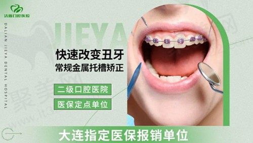 大连洁雅口腔金属托槽牙齿矫正仅5880元起，矫正技术好价格便宜！