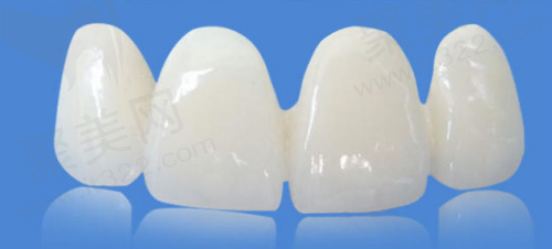 烤瓷牙和全瓷牙哪种好？做烤瓷牙的价格一般多少钱一颗？