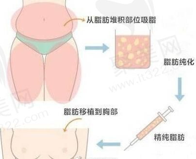 2023北京脂肪填充修复哪里好?这里有北京做脂肪修复的大佬汇总