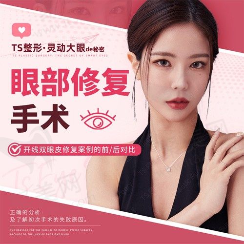TS解析：眼部修复手术 - 开线双眼皮修复案例的前/后对比