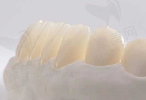 看到广告上爱尔创全瓷牙800元一颗是真是假？爱尔创全瓷牙非常新价格分享