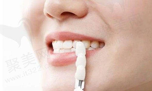 医生说皓齿美白白不了多少，那么是冷光美白好还是皓齿美白好？