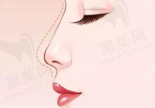 韩国隆鼻整形医院排名前十名单公开，本地整容达人力推这10家