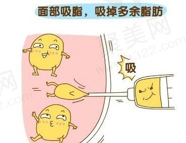 面部吸脂价格大概多少钱？面部吸脂后会不会导致皮肤松弛？