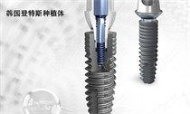 韩国登特斯种植体