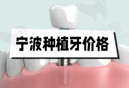 宁波种植牙多少钱一颗2023年？顺便看看宁波种植牙哪家口腔医院好