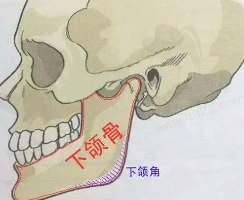 下颌角宽大怎么改善？磨骨手术风险大吗？磨骨需要多少钱？