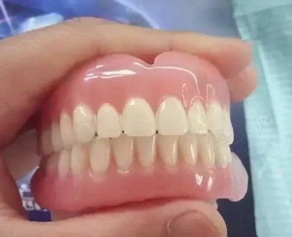 不用磨牙的镶牙方法有哪些？对比几种不同的不伤邻牙的镶牙方法！
