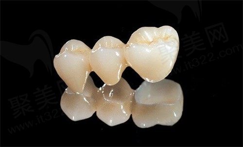 二氧化锆牙分几个档次？想知道国产全瓷牙品牌十大排名有哪些