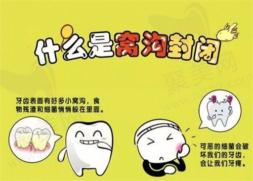 孩子做窝沟封闭有必要吗？小孩做了窝沟封闭就不会烂牙吗？
