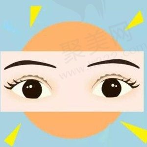 北京华韩谢立宁医生做眼部整形真是绝了，让我拥有灵动有神的眼眸！