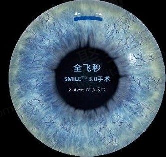 全飞秒