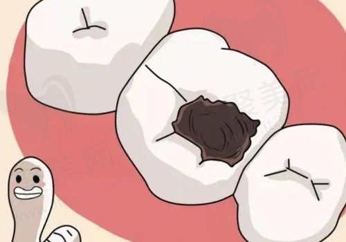 儿童做牙冠多少钱一颗?儿童做牙冠的种类有哪些,都有什么优点！