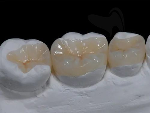 美学树脂补牙多少钱一颗？美学树脂补牙跟普通树脂有什么区别？