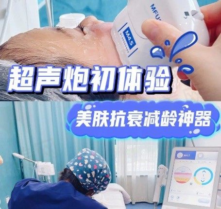 做一次超声炮的价格是多少钱？想知道做完超声炮会不会加速衰老？