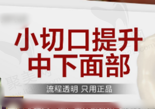 上海伯思立倪峰拉皮技术不错，中下面部拉皮45000元起口碑好