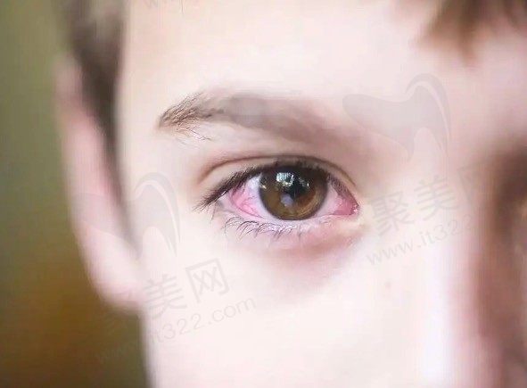 18种常见眼科疾病及症状图片，看看眼科常见的疾病有哪些？