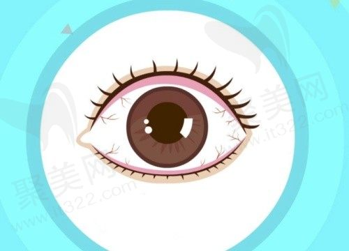 干眼症可以做近视手术吗？干眼症是什么引起的，如何治疗？