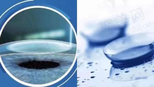 近视做飞秒手术好还是戴角膜塑形镜好？要从两者的价格、使用成效等方面来选择！
