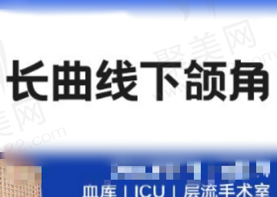 四川友谊医院罗恩下颌角手术怎么收费？长曲线下颌角整形19770元起
