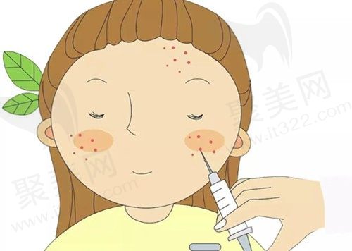 少女针和濡白天使填充哪个好？详细介绍各自优势有哪些？