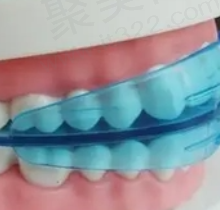 给大家看我在南京固德口腔找刘春医生做的正畸全过程，脸部改善非常明显！