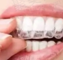 在金华婺城口腔做正畸的体验感超好，周亚军医生的技术惊艳到我