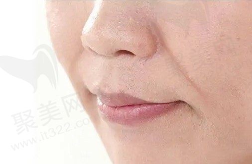 法令纹深怎么去除？通过法令纹去除小妙招告诉你如何淡化法令纹！